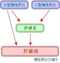 肝炎外来のご案内